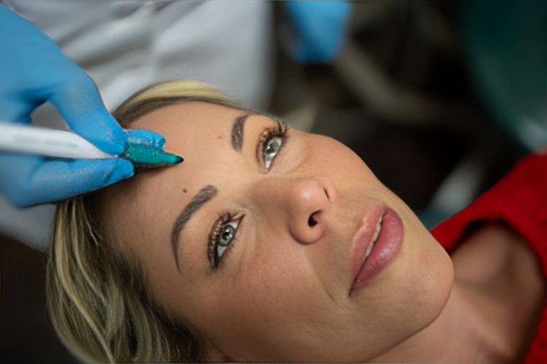 Botox Treatment in Coquitlam