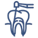 Root Canal Treatment