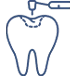 White Tooth Fillings