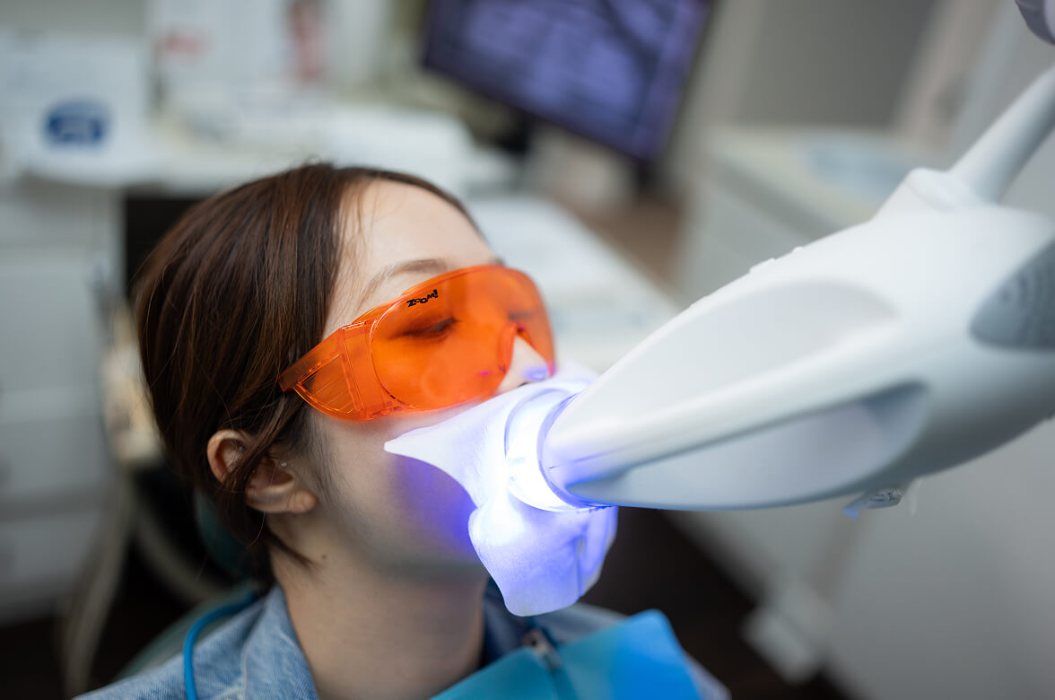 Zoom teeth whitening in Coquitlam