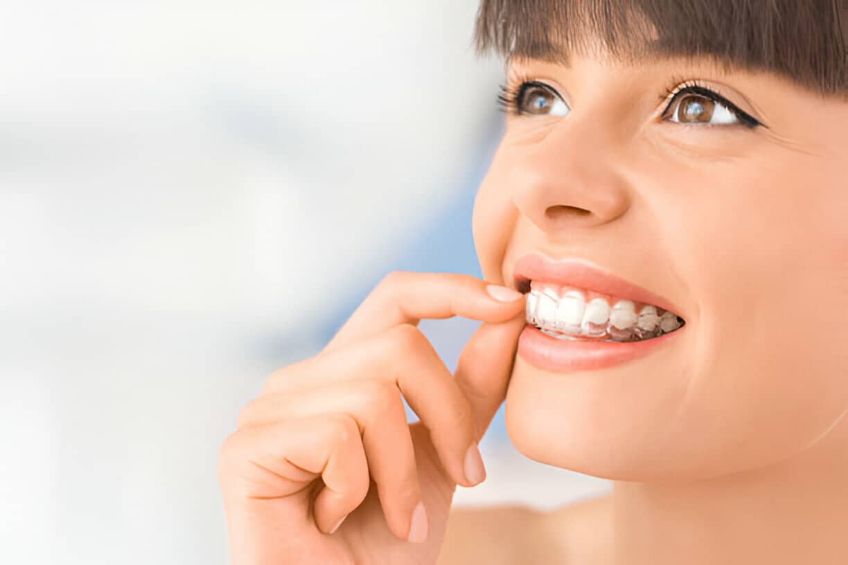 Are Invisalign Aligners As Effective As Braces?