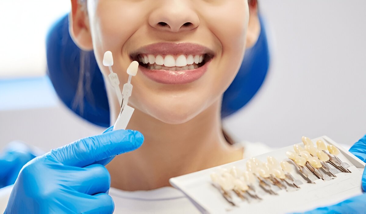 Dental Veneers in Coquitlam